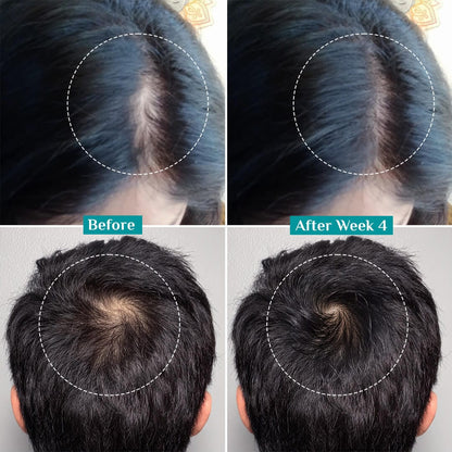 3% Redensyl, 4% Anagain & 5% Capilia Stem Cell Complex Advanced Hair Growth Serum Roll-On