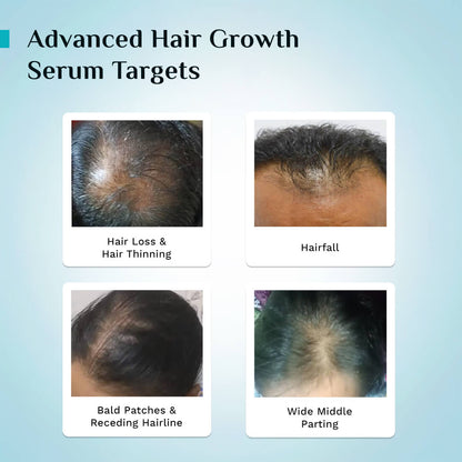 3% Redensyl, 4% Anagain & 5% Capilia Stem Cell Complex Advanced Hair Growth Serum Roll-On