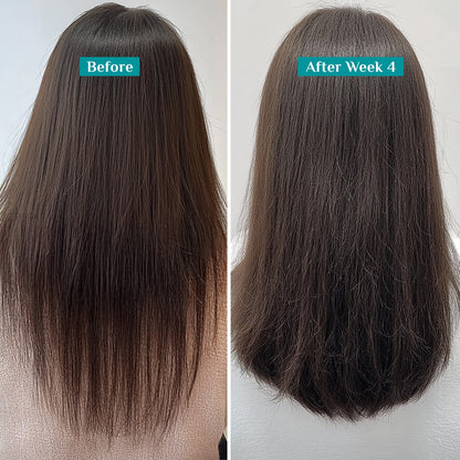 Redensyl & Anagain Hairfall Control Shampoo