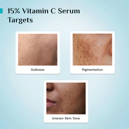 15% Vitamin C Face Serum For Advanced Brightness (20 ml)