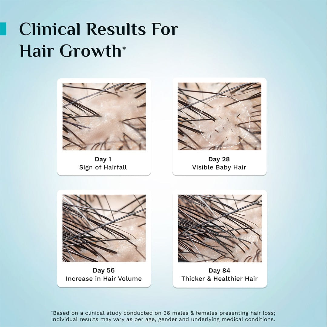 3% Redensyl & 4% Anagain Advanced Hair Growth Serum 100 ml