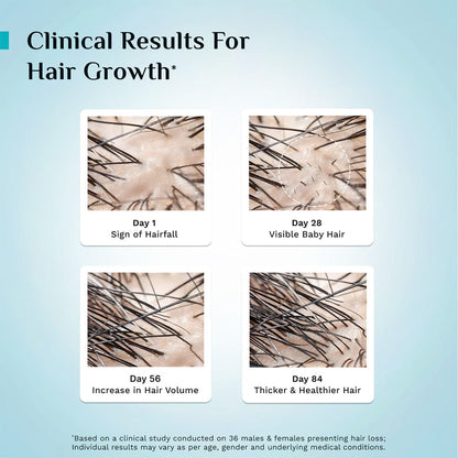 3% Redensyl & 4% Anagain Advanced Hair Growth Serum 100 ml