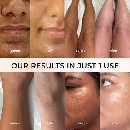 Niconi Tan Vanish Gluta-Kojic Skin Polish  For Easy Tan Removal