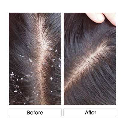 Niconi Anti-Dandruff Shampoo-(180ml)